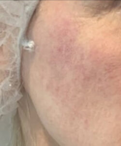 After Image: Vistapen